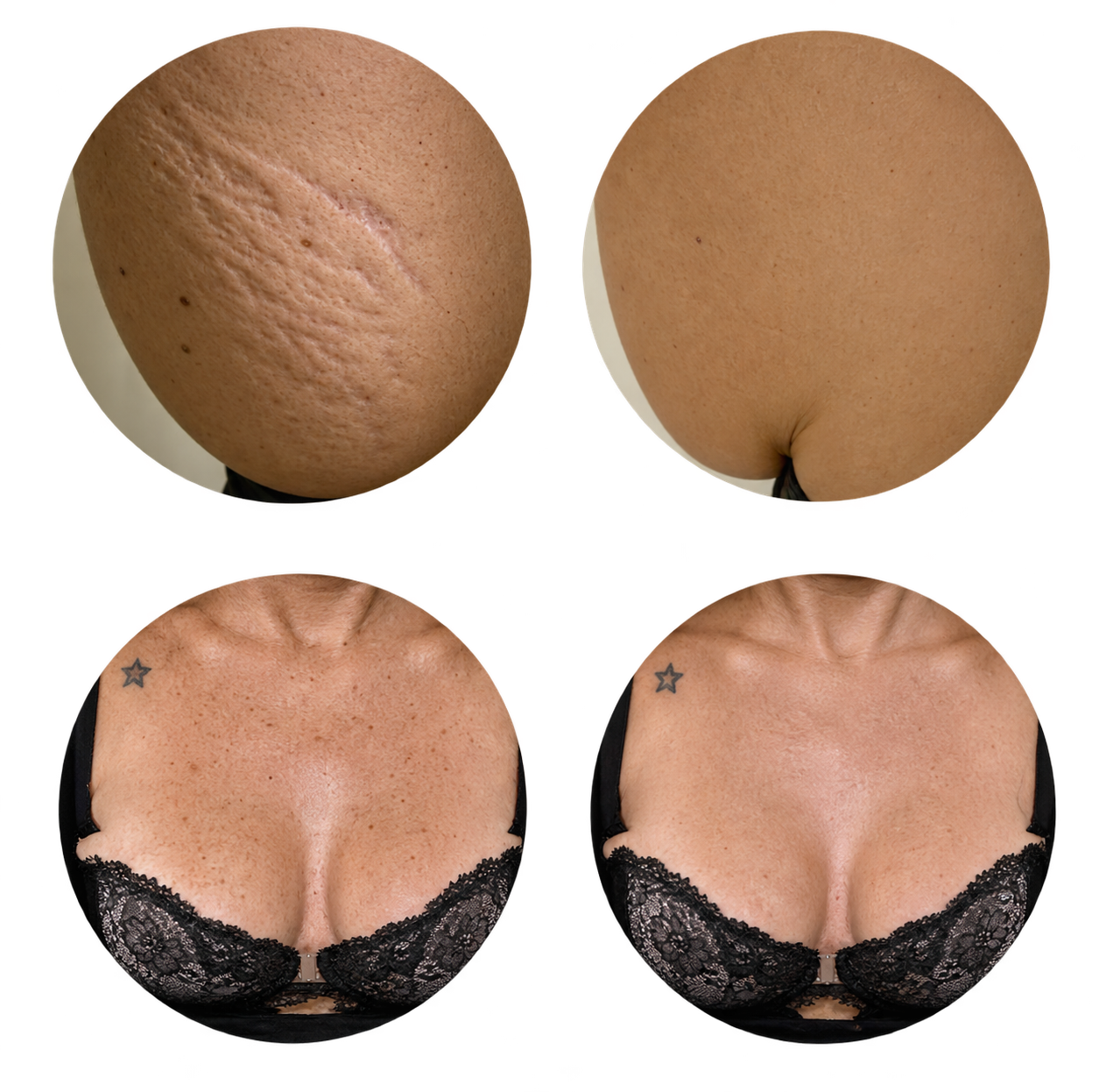 RED TOUCH PRO™ antes e depois